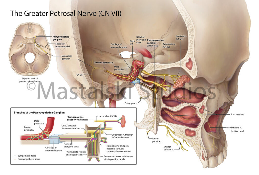 The Greater Petrosal Nerve (CN VII)