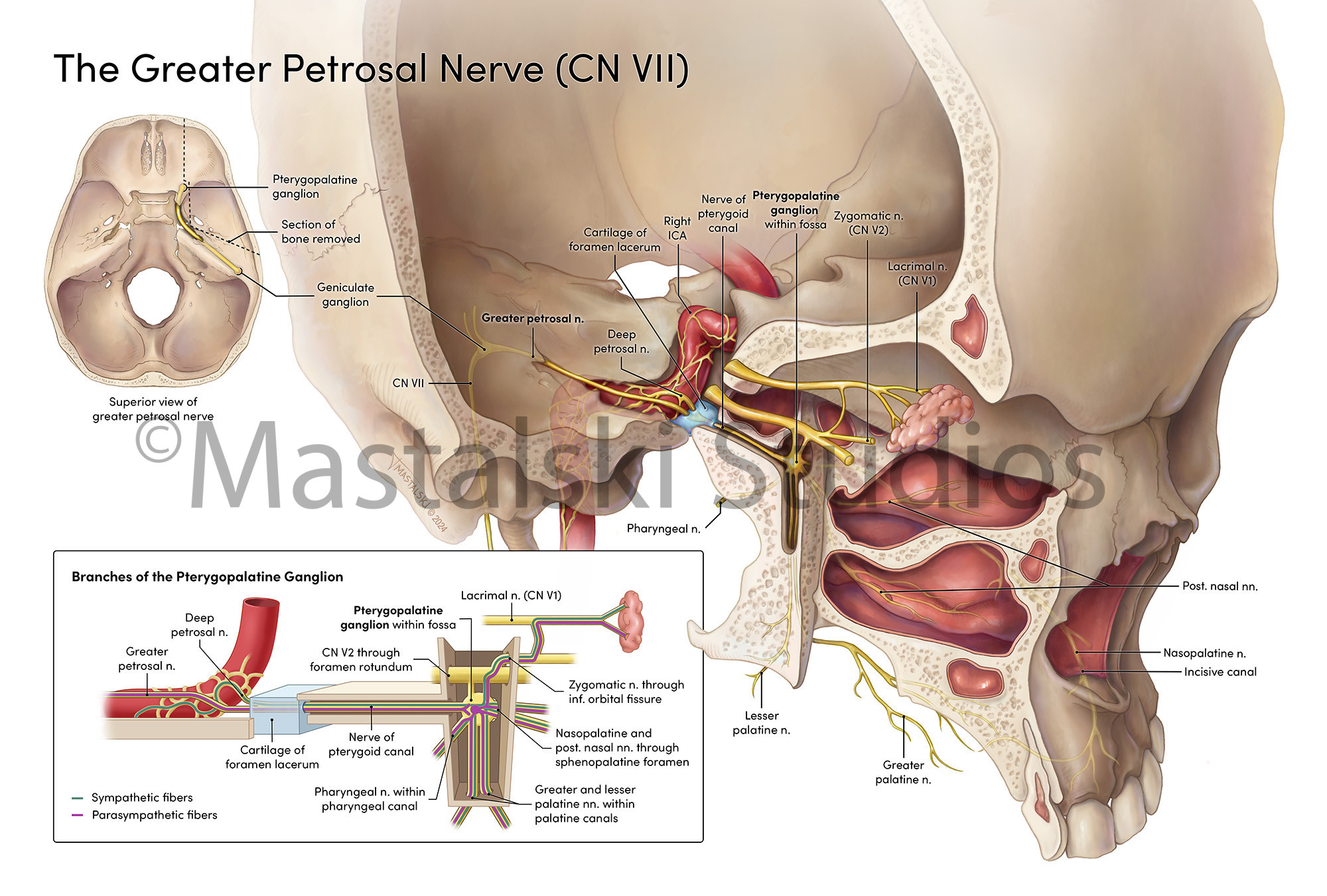 Path of the greater petrosal nerve through the skull and the branches of the pterygopalatine ganglion